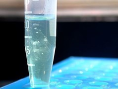 Extraction of DNA from cheek cells