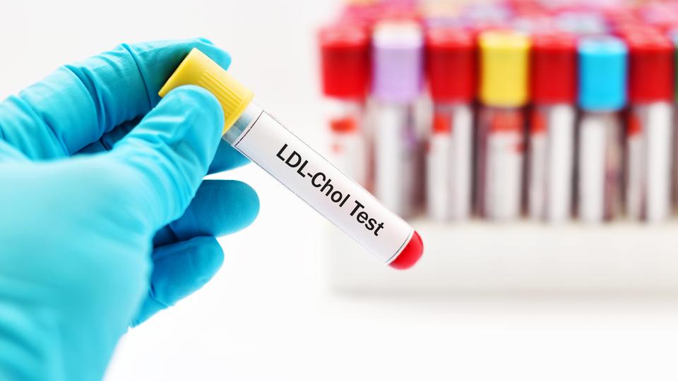 Scientist holding container for blood